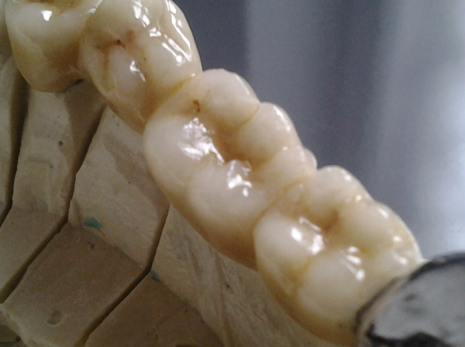 2014-12-01-09.51.111