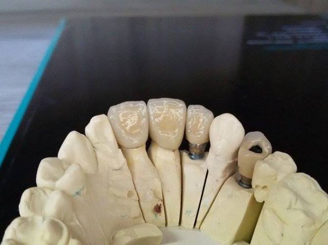 11125455_10205255056449051_1633538012_n