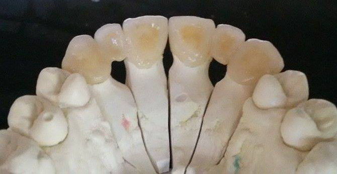 11261083_10205527841468506_1070558764_n