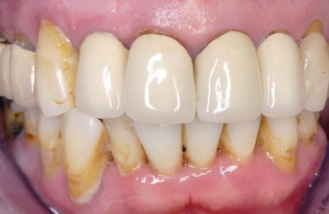 11265898_10153296101500489_1004771878_o