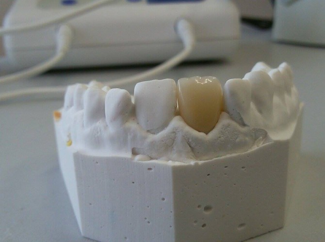 Kvasnovska_Michejda_nova_model_01