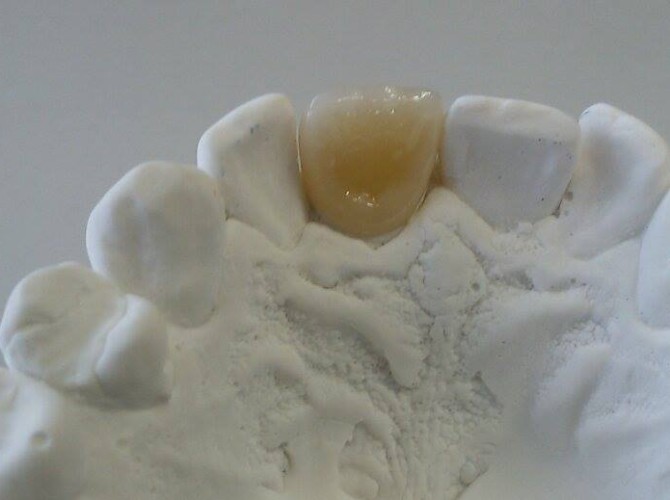 Kvasnovska_Michejda_nova_model_02